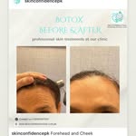 Anti-aging highlight