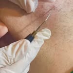 Procedures highlight
