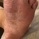 Skin care highlight